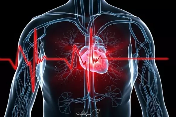 لیست بیماری ها و شرایط معافیت پزشکی بیماری های قلبی و عروقی